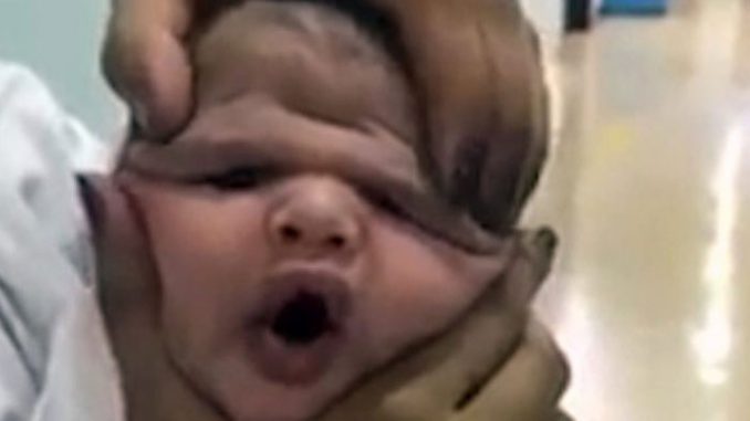 Νοσοκόμες παραμόρφωσαν πρόσωπο μωρού, γέλασαν και απολύθηκαν (Βίντεο)